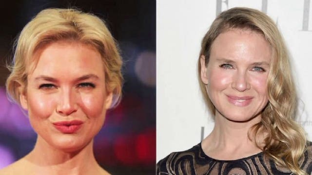 The debate about Renee Zellweger's new look rages on