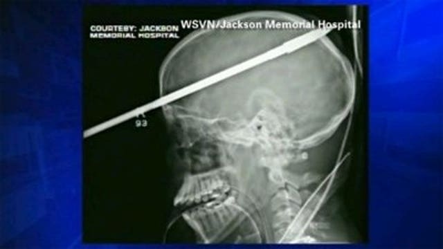 Florida teen survives being "speared" while fishing