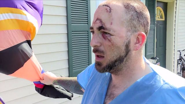 Man sliced with box cutter after confronting man vandalizing his Minnesota Vikings inflatable