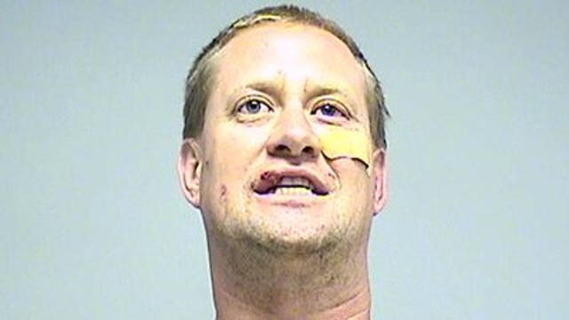 Two Walworth Co. deputies bitten by pit bulls during arrest