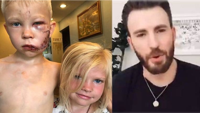 Bridger Walker, 6, is pictured with his younger sister after the dog attack with roughly 90 stitches in his face, alongside a screengrab of actor Chris Evans who sent a video message to the young boy praising him for his bravery. (Photo credit: nicolenoelwalker / Instagram)