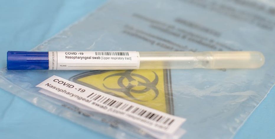 Wisconsin DHS auto-importing positive COVID-19 test results