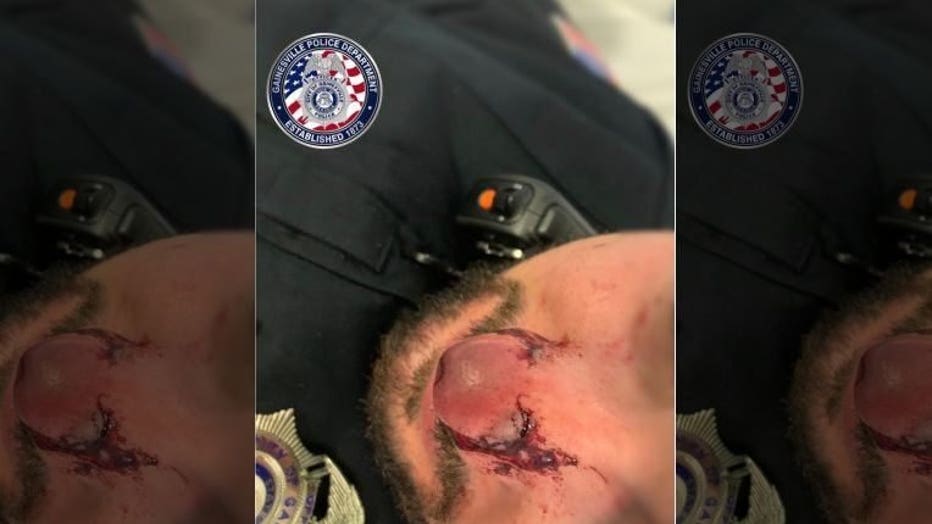 Gainesville Police shared a photo of the injury on Facebook.