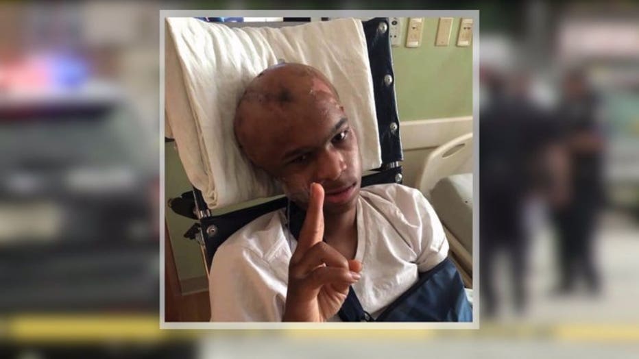 'It Was A Miracle:' Teen Survives Being Shot In Head, Recovers From ...