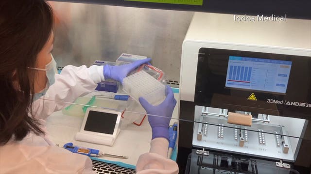 Company developing 5-minute COVID-19 test partners with Wisconsin lab