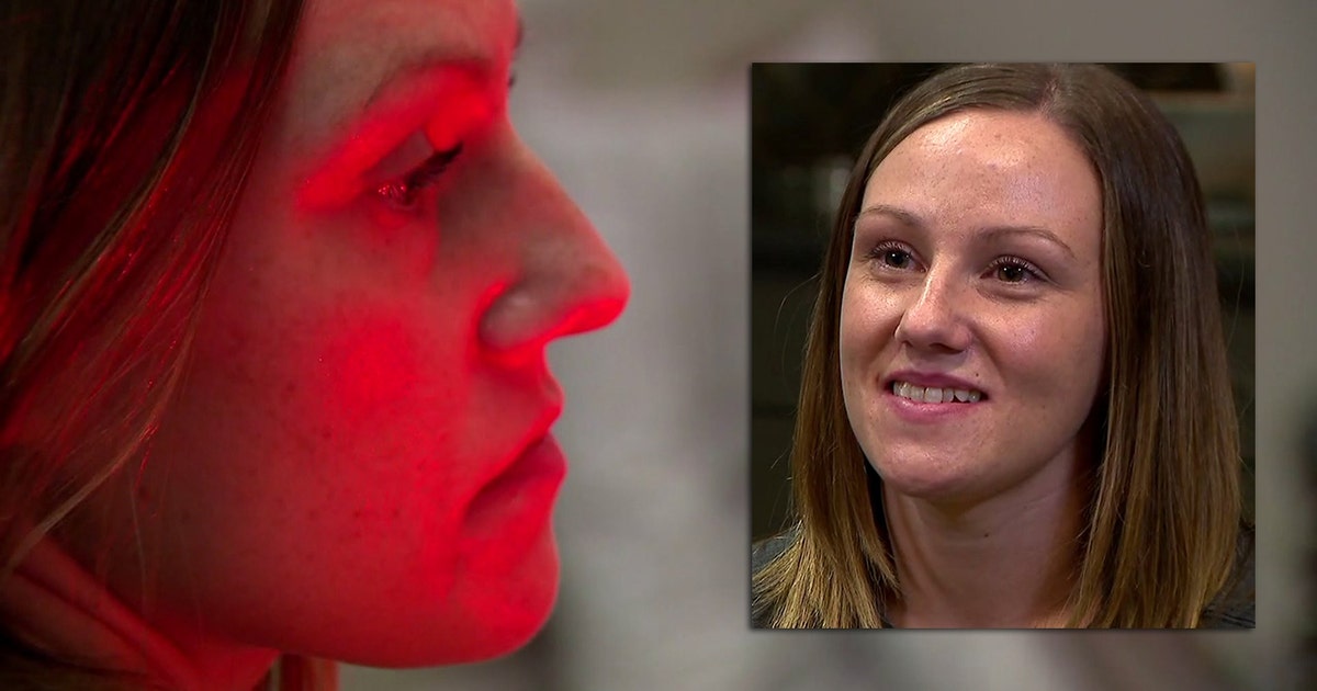 Woman set on fire by stranger speaks on camera about her healing | FOX6 ...