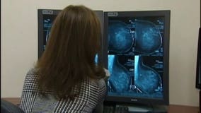 Breast cancer research at risk amid the coronavirus pandemic