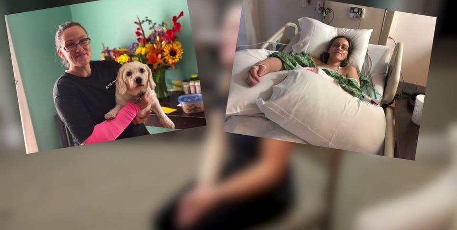 Co-workers, clients, strangers raise thousands for Waukesha woman set on fire