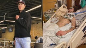 Brookfield East's 'No. 1 varsity racer' in coma after ski accident