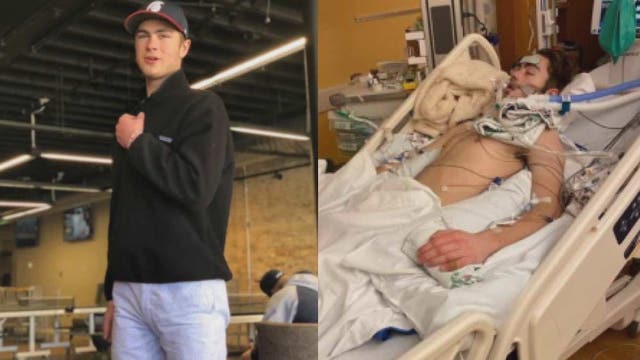 Brookfield East's 'No. 1 varsity racer' in coma after ski accident