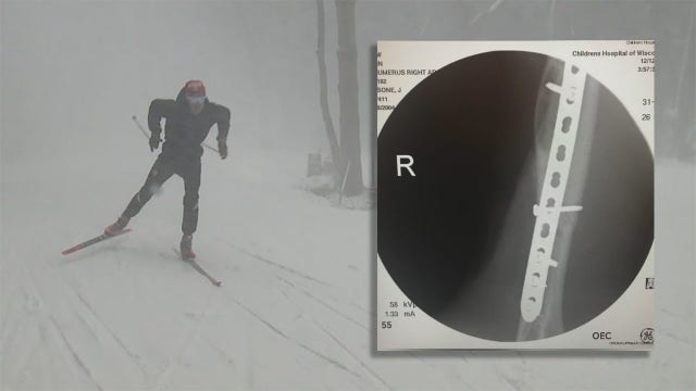 Teen skier pushes past surgeries, broken bones, wins team title