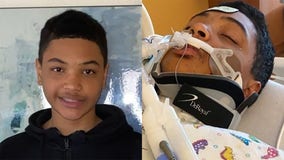 Racine boy shot riding scooter, may never walk again