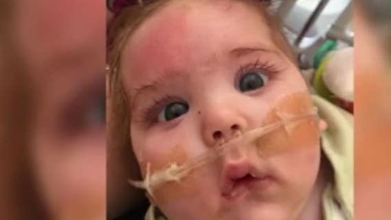 Judah Strong: Kenosha baby sees community support