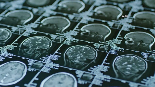 Dementia is inevitable, half of adults say, according to AARP survey