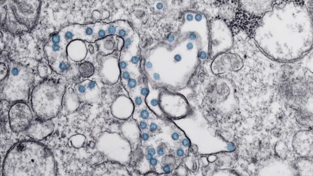 COVID disrupts some kids' immunizations; unexpected virus present