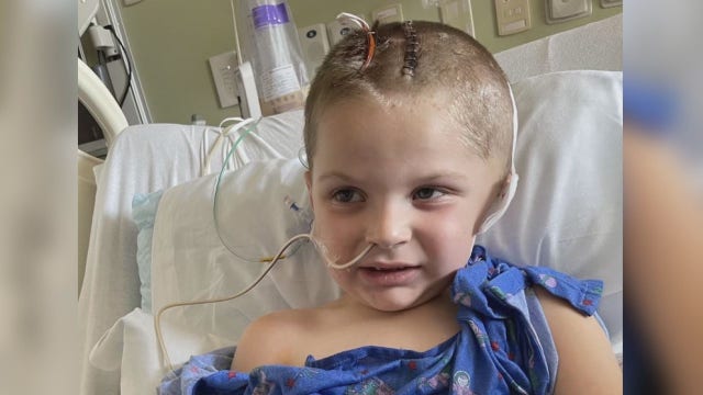 Motorcycle ride benefits boy injured in lawnmower accident