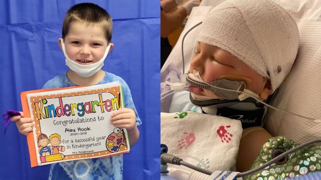 Boy still in critical condition after being hit by a projectile