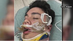 Family of Brazosport HS teen brutally beaten file $50 million lawsuit against teens involved, their parents