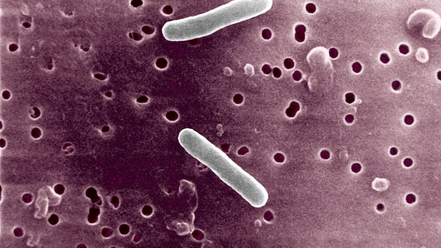 Salmonella: 6 sick from 'shelled peas' from WI farmer's markets