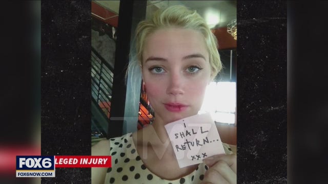 Amber Heard's bloody lip picture: TMZ