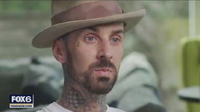 Travis Barker hospitalized