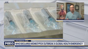 Monkeypox: What you need to know