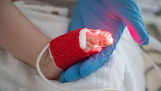 Children's Wisconsin believes RSV has peaked in the region