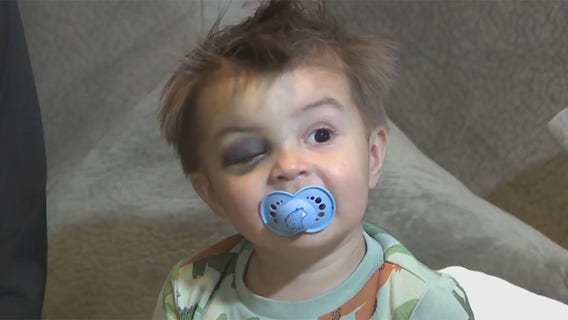 Plymouth High School fall, boy recovering after 15-foot drop