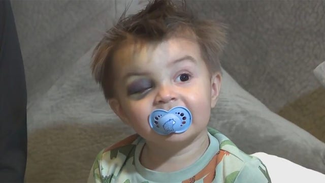 Plymouth High School fall, boy recovering after 15-foot drop