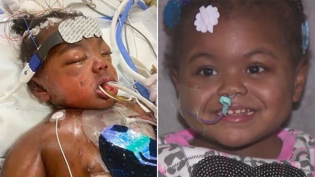 RSV, heart surgeries; Milwaukee girl home after months in hospital