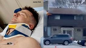 Milwaukee firefighter fell from roof, badly hurt; daughter's kidney failing
