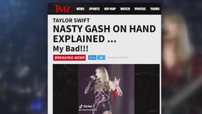 Taylor Swift's injury goes viral