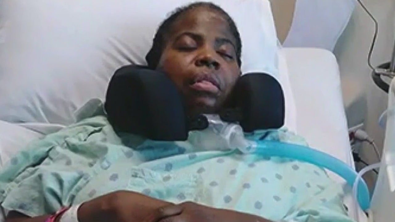 Milwaukee hit-and-run survivor ‘strong’ 6 years later despite no arrests