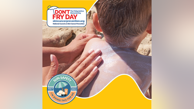 Don't Fry Day; National Council on Skin Cancer Prevention