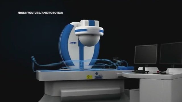 Micro camera, giant magnet changing how doctors diagnose stomach aliments