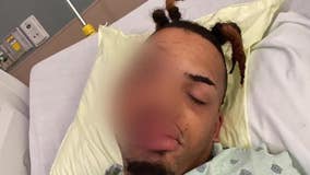 Shot in the face, Milwaukee father a 'walking miracle'