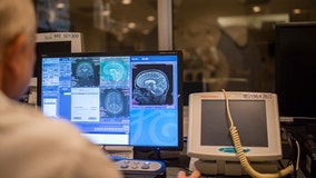 Alzheimer's drugs may enter brain faster with new ultrasound tool, study finds