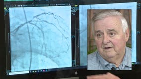 Greenfield man shares heart disease lesson; hopes it'll save a life