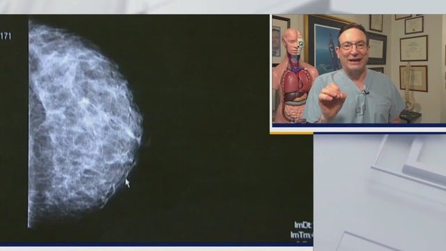 New breast cancer screening recommendations