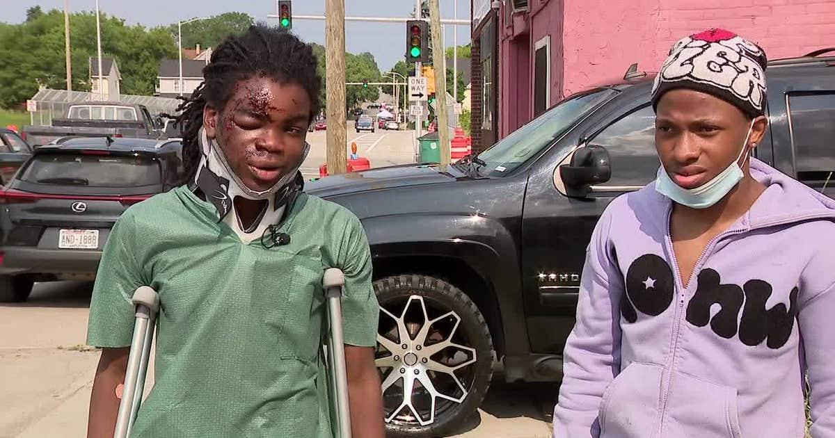 Milwaukee teens on scooters hit by vehicle; driver sped away | FOX6 ...