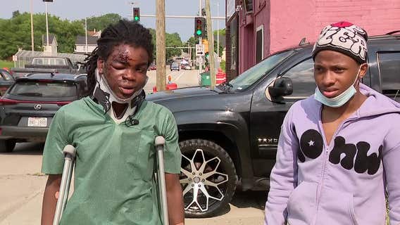 Milwaukee teens on scooters hit by vehicle; driver sped away