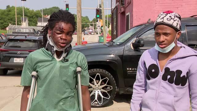 Milwaukee teens on scooters hit by vehicle; driver sped away
