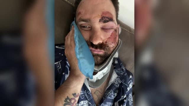 Milwaukee Army reservist violently attacked; family seeks answers