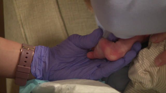 Newborn screening; Wisconsin takes 1st step in checking for Krabbe disease
