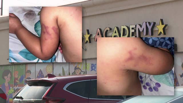 Kenosha day care employee accused of child abuse, 'staging' accident