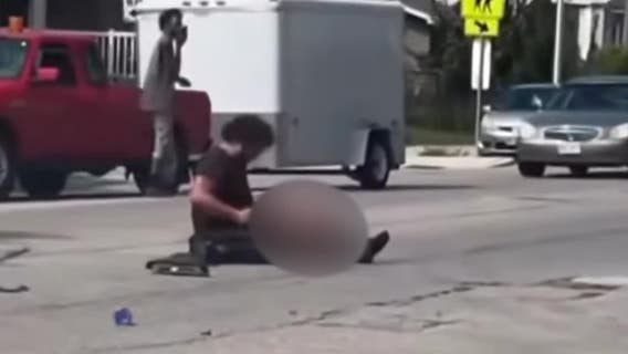 Milwaukee hit-and-run motorcycle crash; man loses leg on his birthday