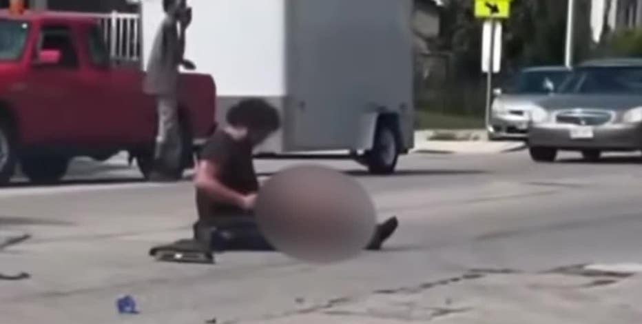 Milwaukee hit-and-run motorcycle crash; man loses leg on his birthday