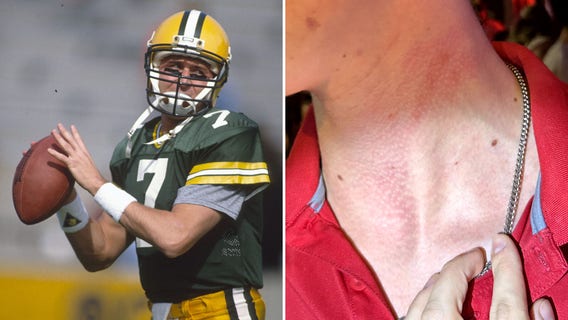 Ex-Packers QB Don Majkowski cited, Eau Claire bar incident: police