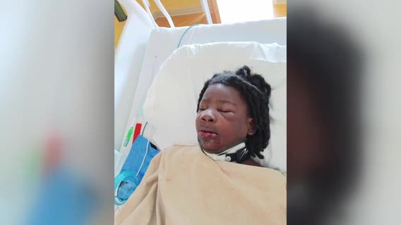 Milwaukee hit-and-run, child injured at 35th and Scott; mother wants justice