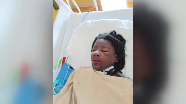 Milwaukee hit-and-run, child injured at 35th and Scott; mother wants justice
